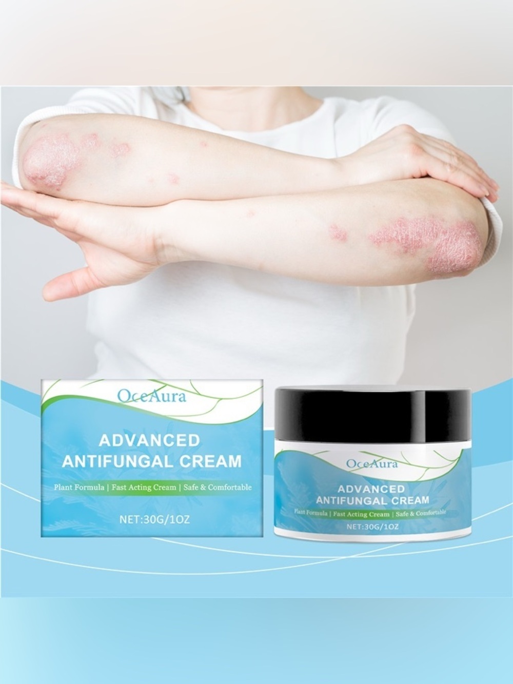 OceAura Advanced Antifungal Cream NEW